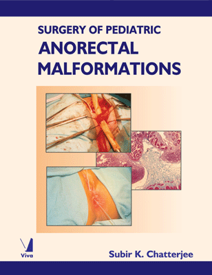 Surgery of Pediatric Anorectal Malformations