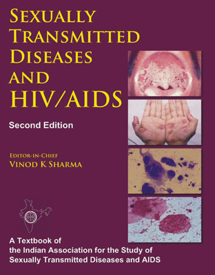 Sexually Transmitted Diseases and HIV/AIDS, 2/e